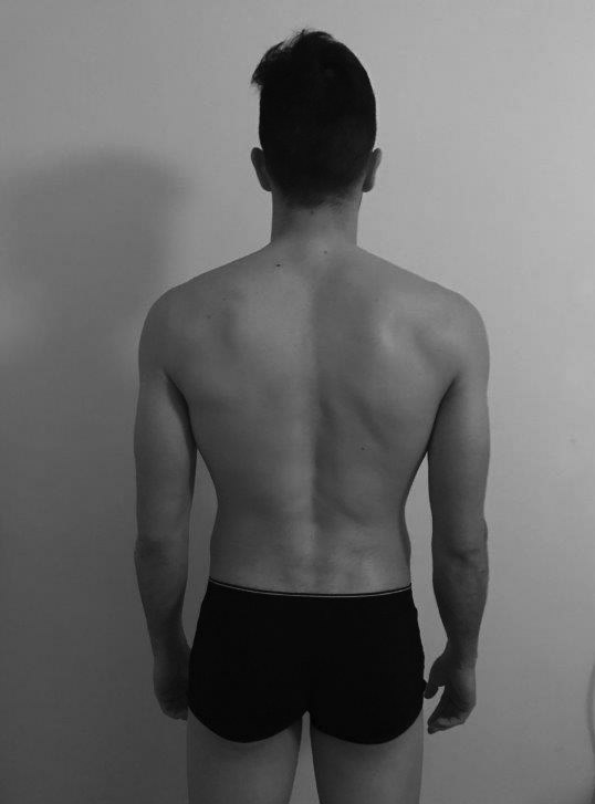 Corrección postural